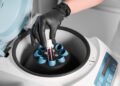 prp injections